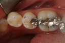 John Wu #20 pre-op