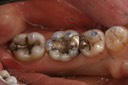 Ted Kanamori #29, 30, 31 pre-op