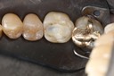 Ted Kanamori #19 pre-op