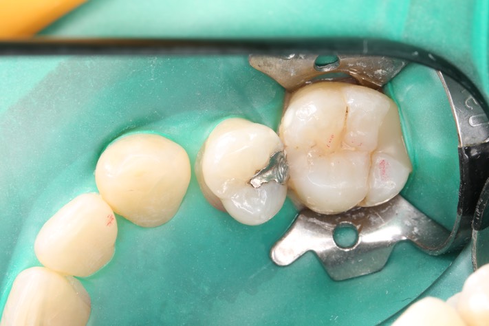 Wes Sato #4 pre-op