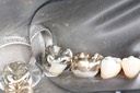 Russ Tabata #18 finish buccal view