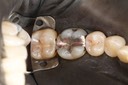 Scott Kanamori #30 pre-op