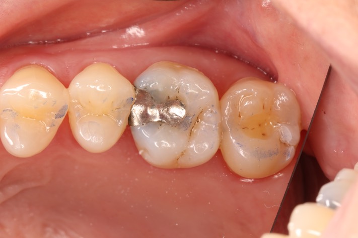 Scott Kanamori #3 pre-op