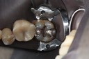 Alan Tamashiro #18 pre-op