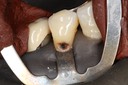 Ted Kanamori #28 pre-op