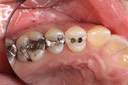 Gary Umeda #12 - 13 pre-op