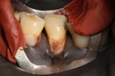 Ted Kanamori #20 pre-op