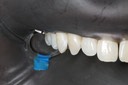 Bryan Sato #5 buccal view