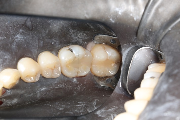 Gary Umeda #18-19 pre-op