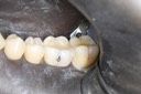Gary Umeda #18-19 pre-op 2