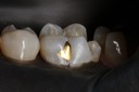 Gary Umeda #19 buccal