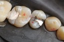 Scott Kanamori #14 pre-op