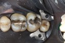 Ted Kanamori #2 pre-op