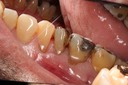Chris Woo #13 buccal view