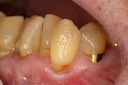 Ted Kanamori #24 pre-op
