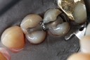 Wes Sato #4 pre-op