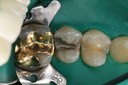 Mendel Sato #13 pre-op