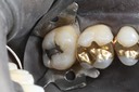 Ted Kanamori #15 pre-op