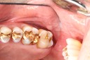 Gary Umeda #2 pre-op