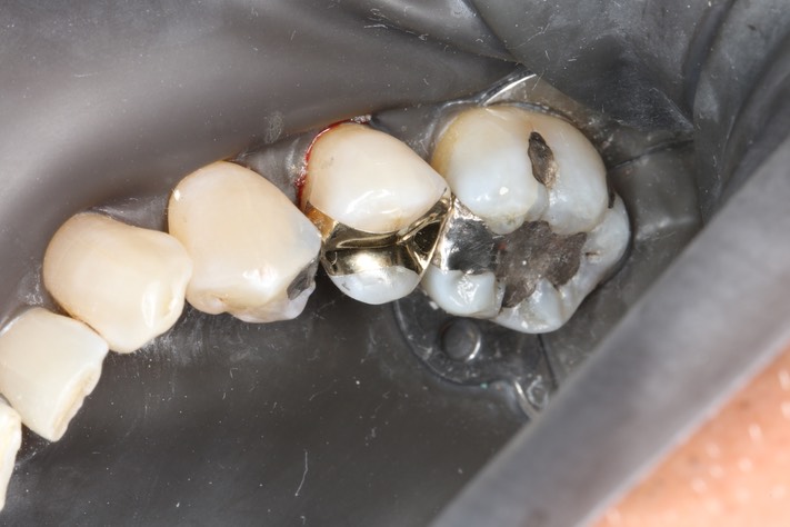 Wes Sato #29 finish buccal view