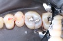 Wes Sato #3 pre-op
