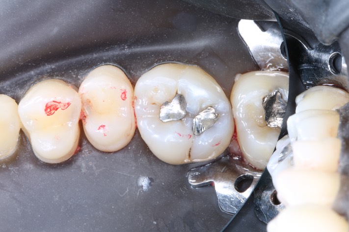 Wes Sato #3 pre-op