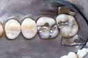 Ted Kanamori #2-3 pre-op