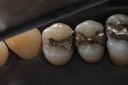 Wayne Chin #5 pre-op