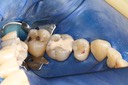 Mark Chun #14 pre-op