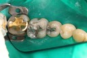 Ted Kanamori #29 - 30 pre-op