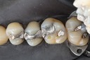 Gary Umeda #3,4,5 pre-op