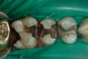 26Larry Fujioka #11-12 pre-op