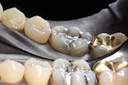36Frank Fukuda #19 lingual pre-op