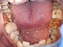 _DSC6176