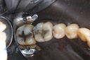 Frank Fukuda #30 pre-op
