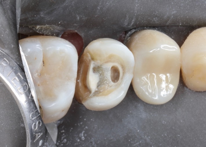 Gary Umeda #13 prep