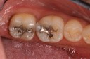 Gary Umeda #30-31 pre-op