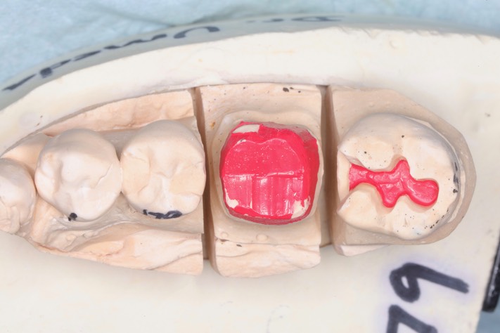 Gary Umeda model