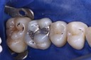 Scott Kanamori #14 pre-op