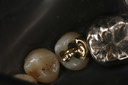 Wayne Chin #20 cementation