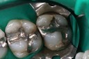 Ted Kanamori #2-3 pre-op