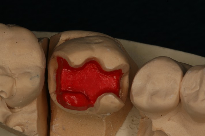 Scott Kanamori model