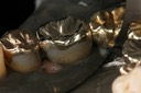 Chris Woo cementation