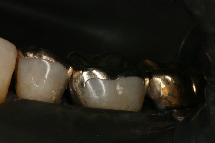 Chris Woo cementation