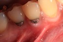 Gary Umeda #28 pre-op