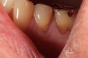Ted Kanamori #20 pre-op