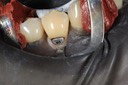 Gary Umeda #28 pre-op