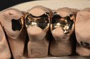 Gary Umeda #12,12,13 castings