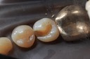 Larry Fujioka #20 composite removal