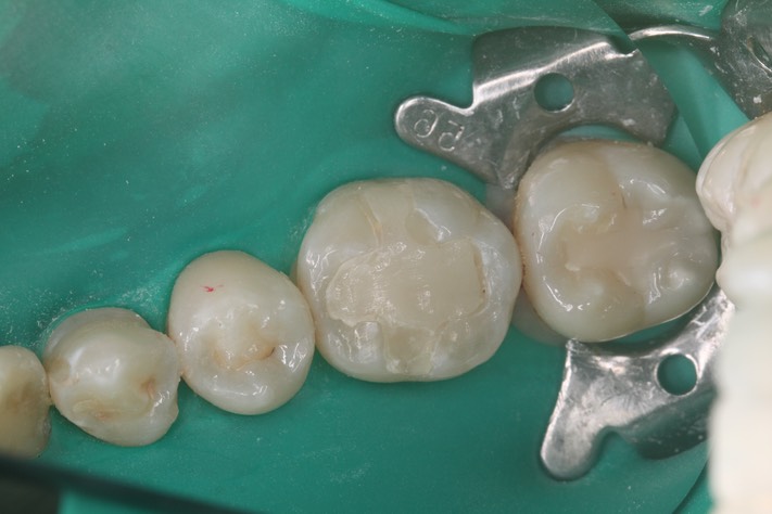 Wes Sato #19 pre-op